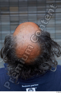 Street  648 bald hair head 0002.jpg